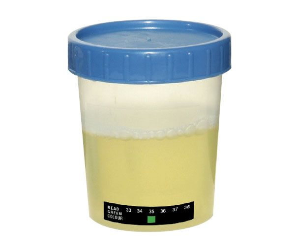 Urine Temperature Strip, 33 38°C, Reversible, Size 38 x 8mm (62 Per